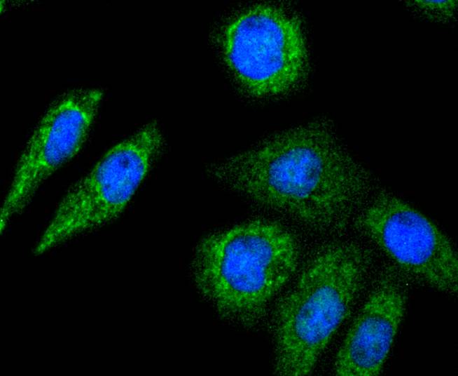 ICC staining DIABLO in LO2 cells (green). The nuclear counter stain is DAPI (blue). Cells were fixed in paraformaldehyde, permeabilised with 0.25% Triton X100/PBS.
