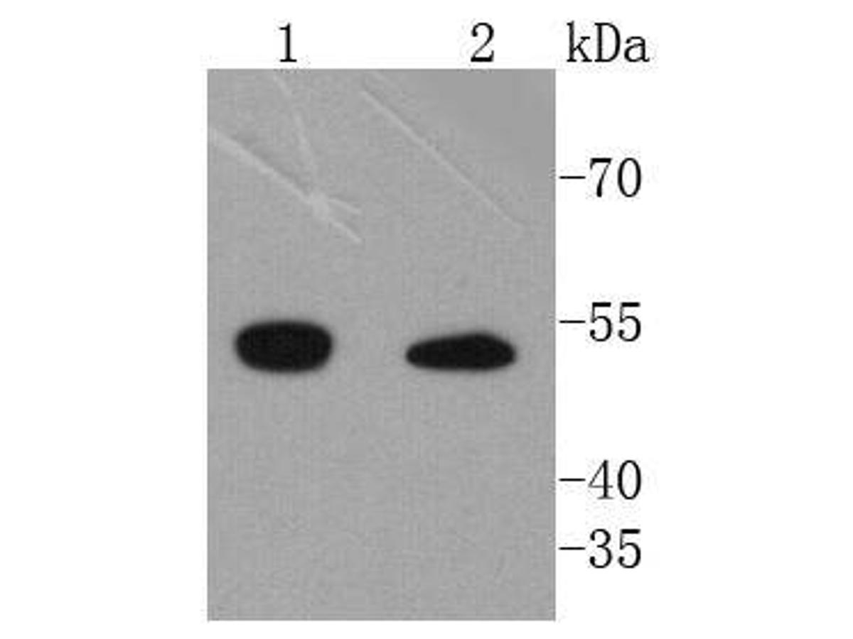 Western blot analysis of Integrin linked ILK on different lysates. Proteins were transferred to a PVDF membrane and blocked with 5% BSA in PBS for 1 hour at room temperature. The primary antibody (ET1610-76, 1/500) was used in 5% BSA at room temperature for 2 hours. Goat Anti-Rabbit IgG - HRP Secondary Antibody (HA1001) at 1:200,000 dilution was used for 1 hour at room temperature.<br />
Positive control: <br />
Lane 1: Hela cell lysate<br />
Lane 2: 293T cell lysate