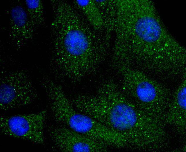 ICC staining of Integrin linked ILK in NIH/3T3 cells (green). Formalin fixed cells were permeabilized with 0.1% Triton X-100 in TBS for 10 minutes at room temperature and blocked with 1% Blocker BSA for 15 minutes at room temperature. Cells were probed with the primary antibody (ET1610-76, 1/50) for 1 hour at room temperature, washed with PBS. Alexa Fluor®488 Goat anti-Rabbit IgG was used as the secondary antibody at 1/1,000 dilution. The nuclear counter stain is DAPI (blue).