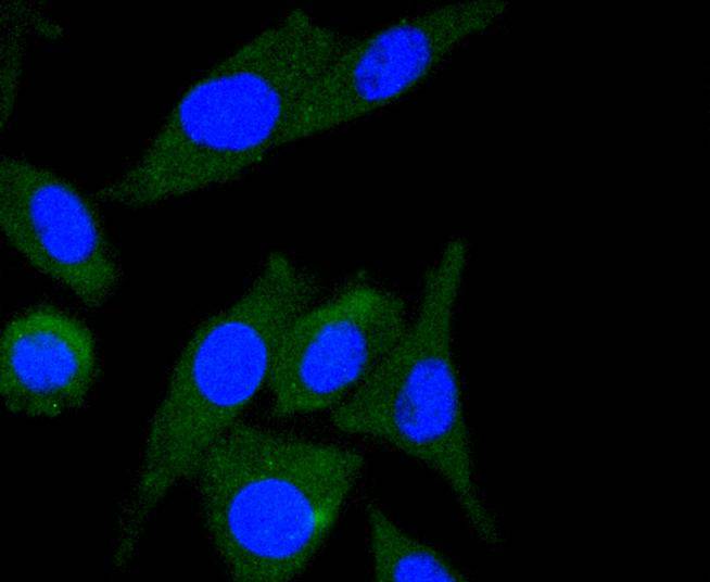ICC staining of Integrin linked ILK in SH-SY5Y cells (green). Formalin fixed cells were permeabilized with 0.1% Triton X-100 in TBS for 10 minutes at room temperature and blocked with 1% Blocker BSA for 15 minutes at room temperature. Cells were probed with the primary antibody (ET1610-76, 1/50) for 1 hour at room temperature, washed with PBS. Alexa Fluor®488 Goat anti-Rabbit IgG was used as the secondary antibody at 1/1,000 dilution. The nuclear counter stain is DAPI (blue).
