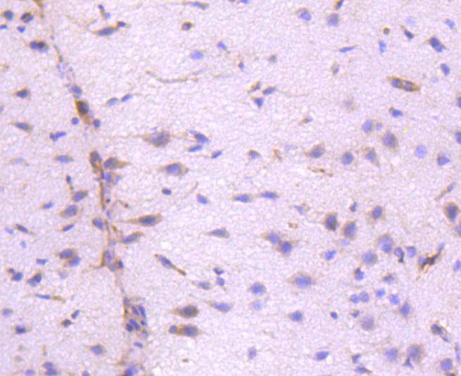 Immunohistochemical analysis of paraffin-embedded rat brain tissue using anti-Integrin linked ILK antibody. The section was pre-treated using heat mediated antigen retrieval with Tris-EDTA buffer (pH 8.0-8.4) for 20 minutes.The tissues were blocked in 5% BSA for 30 minutes at room temperature, washed with ddH2O and PBS, and then probed with the primary antibody (ET1610-76, 1/50) for 30 minutes at room temperature. The detection was performed using an HRP conjugated compact polymer system. DAB was used as the chromogen. Tissues were counterstained with hematoxylin and mounted with DPX.