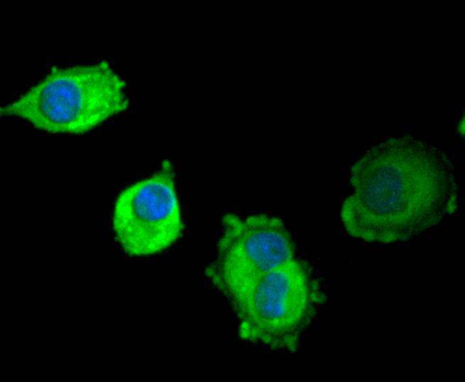 ICC staining of SCF in PANC-1 cells (green). Formalin fixed cells were permeabilized with 0.1% Triton X-100 in TBS for 10 minutes at room temperature and blocked with 1% Blocker BSA for 15 minutes at room temperature. Cells were probed with the primary antibody (ET1610-77, 1/50) for 1 hour at room temperature, washed with PBS. Alexa Fluor®488 Goat anti-Rabbit IgG was used as the secondary antibody at 1/1,000 dilution. The nuclear counter stain is DAPI (blue).