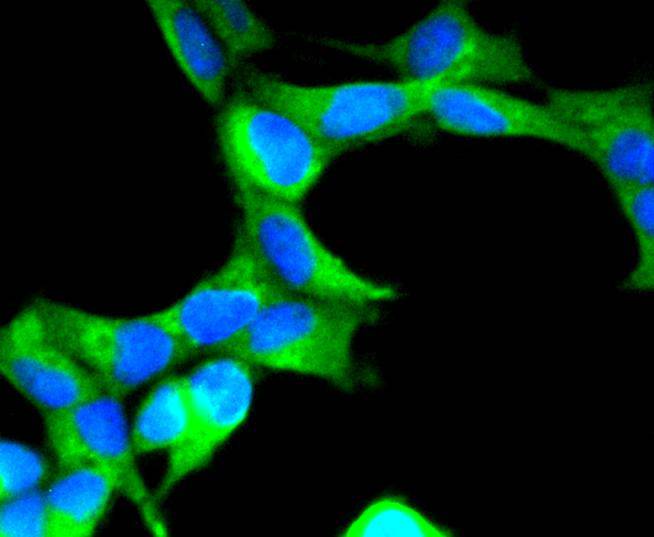 ICC staining of SCF in 293 cells (green). Formalin fixed cells were permeabilized with 0.1% Triton X-100 in TBS for 10 minutes at room temperature and blocked with 1% Blocker BSA for 15 minutes at room temperature. Cells were probed with the primary antibody (ET1610-77, 1/50) for 1 hour at room temperature, washed with PBS. Alexa Fluor®488 Goat anti-Rabbit IgG was used as the secondary antibody at 1/1,000 dilution. The nuclear counter stain is DAPI (blue).