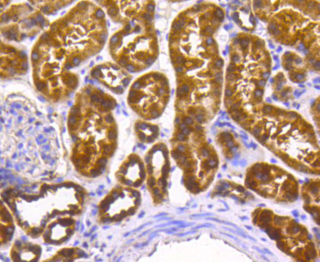 Immunohistochemical analysis of paraffin-embedded human kidney tissue using anti-SCF antibody. The section was pre-treated using heat mediated antigen retrieval with Tris-EDTA buffer (pH 8.0-8.4) for 20 minutes.The tissues were blocked in 5% BSA for 30 minutes at room temperature, washed with ddH2O and PBS, and then probed with the primary antibody (ET1610-77, 1/50) for 30 minutes at room temperature. The detection was performed using an HRP conjugated compact polymer system. DAB was used as the chromogen. Tissues were counterstained with hematoxylin and mounted with DPX.