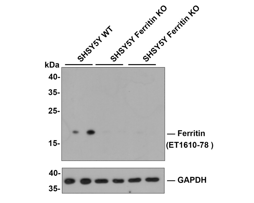 Western blot analysis of Ferritin on zebrafish tissue lysates. Proteins were transferred to a PVDF membrane and blocked with 5% BSA in PBS for 1 hour at room temperature. The primary antibody (ET1610-78, 1/500) was used in 5% BSA at room temperature for 2 hours. Goat Anti-Rabbit IgG - HRP Secondary Antibody (HA1001) at 1:5,000 dilution was used for 1 hour at room temperature.