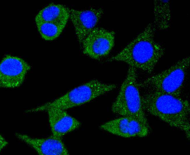 ICC staining of Ferritin in SH-SY5Y cells (green). Formalin fixed cells were permeabilized with 0.1% Triton X-100 in TBS for 10 minutes at room temperature and blocked with 1% Blocker BSA for 15 minutes at room temperature. Cells were probed with the primary antibody (ET1610-78, 1/50) for 1 hour at room temperature, washed with PBS. Alexa Fluor®488 Goat anti-Rabbit IgG was used as the secondary antibody at 1/1,000 dilution. The nuclear counter stain is DAPI (blue).