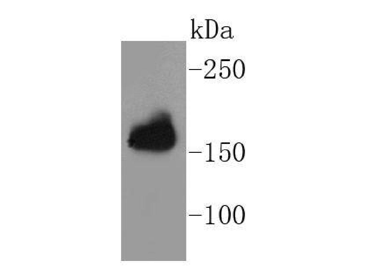 Western blot analysis of APC on mouse brain tissue lysates. Proteins were transferred to a PVDF membrane and blocked with 5% BSA in PBS for 1 hour at room temperature. The primary antibody (ET1610-80, 1/500) was used in 5% BSA at room temperature for 2 hours. Goat Anti-Rabbit IgG - HRP Secondary Antibody (HA1001) at 1:5,000 dilution was used for 1 hour at room temperature.