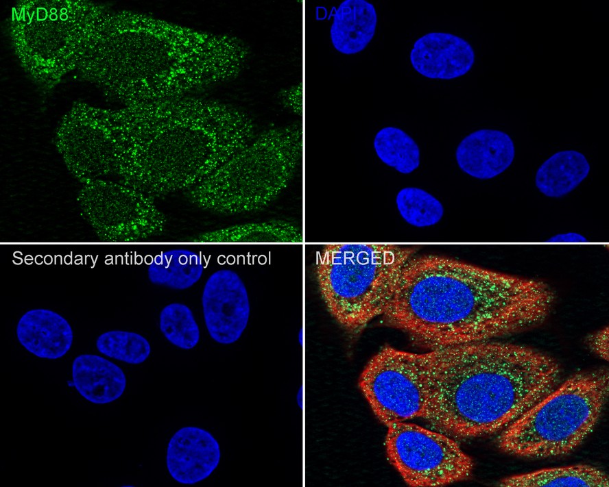 ICC staining of MyD88 in MCF-7 cells (green). Formalin fixed cells were permeabilized with 0.1% Triton X-100 in TBS for 10 minutes at room temperature and blocked with 1% Blocker BSA for 15 minutes at room temperature. Cells were probed with the primary antibody (ET1610-81, 1/50) for 1 hour at room temperature, washed with PBS. Alexa Fluor®488 Goat anti-Rabbit IgG was used as the secondary antibody at 1/1,000 dilution. The nuclear counter stain is DAPI (blue).