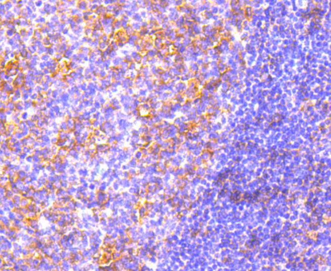 Immunohistochemical analysis of paraffin-embedded human tonsil tissue using anti-MyD88 antibody. The section was pre-treated using heat mediated antigen retrieval with Tris-EDTA buffer (pH 8.0-8.4) for 20 minutes.The tissues were blocked in 5% BSA for 30 minutes at room temperature, washed with ddH2O and PBS, and then probed with the primary antibody (ET1610-81, 1/50) for 30 minutes at room temperature. The detection was performed using an HRP conjugated compact polymer system. DAB was used as the chromogen. Tissues were counterstained with hematoxylin and mounted with DPX.