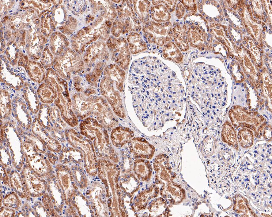 Immunohistochemical analysis of paraffin-embedded human kidney tissue with Rabbit anti-MyD88 antibody (ET1610-81) at 1/200 dilution.<br />
<br />
The section was pre-treated using heat mediated antigen retrieval with Tris-EDTA buffer (pH 9.0) for 20 minutes. The tissues were blocked in 1% BSA for 20 minutes at room temperature, washed with ddH2O and PBS, and then probed with the primary antibody (ET1610-81) at 1/200 dilution for 1 hour at room temperature. The detection was performed using an HRP conjugated compact polymer system. DAB was used as the chromogen. Tissues were counterstained with hematoxylin and mounted with DPX.