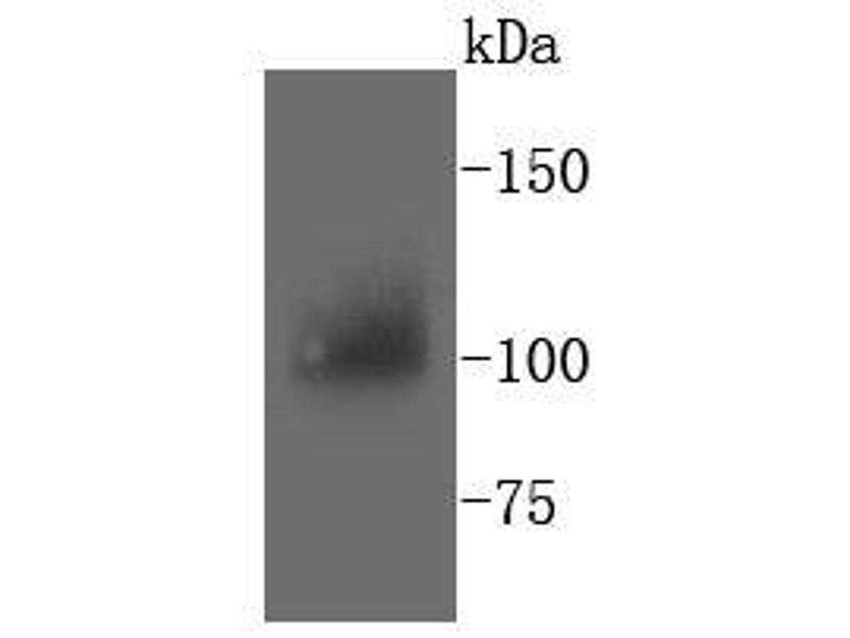Western blot analysis of PYK2 on mouse brain tissue lysates. Proteins were transferred to a PVDF membrane and blocked with 5% BSA in PBS for 1 hour at room temperature. The primary antibody (ET1610-82, 1/500) was used in 5% BSA at room temperature for 2 hours. Goat Anti-Rabbit IgG - HRP Secondary Antibody (HA1001) at 1:5,000 dilution was used for 1 hour at room temperature.