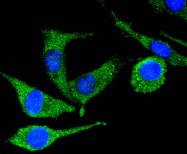 ICC staining of PYK2 in SH-SY5Y cells (green). Formalin fixed cells were permeabilized with 0.1% Triton X-100 in TBS for 10 minutes at room temperature and blocked with 1% Blocker BSA for 15 minutes at room temperature. Cells were probed with the primary antibody (ET1610-82, 1/50) for 1 hour at room temperature, washed with PBS. Alexa Fluor®488 Goat anti-Rabbit IgG was used as the secondary antibody at 1/1,000 dilution. The nuclear counter stain is DAPI (blue).
