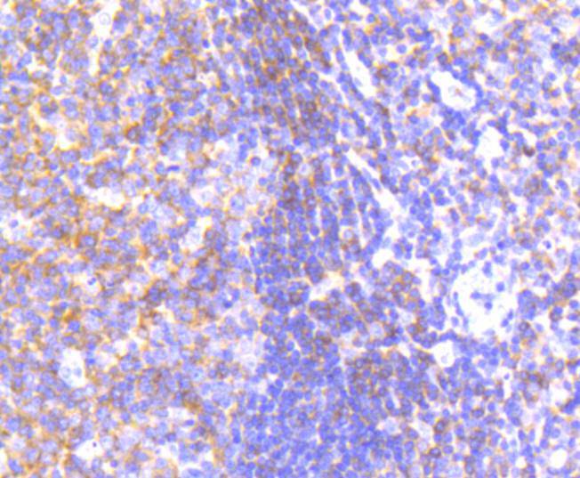 Immunohistochemical analysis of paraffin-embedded human tonsil tissue using anti-PYK2 antibody. The section was pre-treated using heat mediated antigen retrieval with Tris-EDTA buffer (pH 8.0-8.4) for 20 minutes.The tissues were blocked in 5% BSA for 30 minutes at room temperature, washed with ddH2O and PBS, and then probed with the primary antibody (ET1610-82, 1/50) for 30 minutes at room temperature. The detection was performed using an HRP conjugated compact polymer system. DAB was used as the chromogen. Tissues were counterstained with hematoxylin and mounted with DPX.
