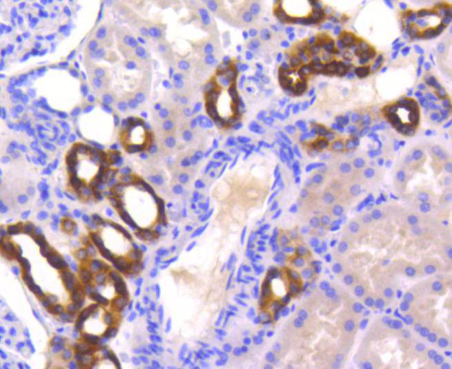 Immunohistochemical analysis of paraffin-embedded human kidney tissue using anti-PYK2 antibody. The section was pre-treated using heat mediated antigen retrieval with Tris-EDTA buffer (pH 8.0-8.4) for 20 minutes.The tissues were blocked in 5% BSA for 30 minutes at room temperature, washed with ddH2O and PBS, and then probed with the primary antibody (ET1610-82, 1/50) for 30 minutes at room temperature. The detection was performed using an HRP conjugated compact polymer system. DAB was used as the chromogen. Tissues were counterstained with hematoxylin and mounted with DPX.