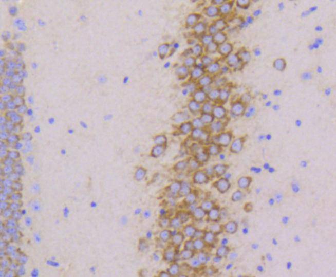 Immunohistochemical analysis of paraffin-embedded mouse brain tissue using anti-PYK2 antibody. The section was pre-treated using heat mediated antigen retrieval with Tris-EDTA buffer (pH 8.0-8.4) for 20 minutes.The tissues were blocked in 5% BSA for 30 minutes at room temperature, washed with ddH2O and PBS, and then probed with the primary antibody (ET1610-82, 1/50) for 30 minutes at room temperature. The detection was performed using an HRP conjugated compact polymer system. DAB was used as the chromogen. Tissues were counterstained with hematoxylin and mounted with DPX.