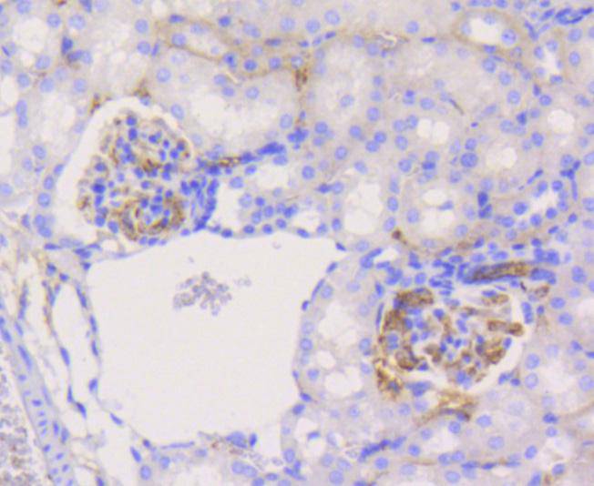 Immunohistochemical analysis of paraffin-embedded mouse kidney tissue using anti-PYK2 antibody. The section was pre-treated using heat mediated antigen retrieval with Tris-EDTA buffer (pH 8.0-8.4) for 20 minutes.The tissues were blocked in 5% BSA for 30 minutes at room temperature, washed with ddH2O and PBS, and then probed with the primary antibody (ET1610-82, 1/50) for 30 minutes at room temperature. The detection was performed using an HRP conjugated compact polymer system. DAB was used as the chromogen. Tissues were counterstained with hematoxylin and mounted with DPX.