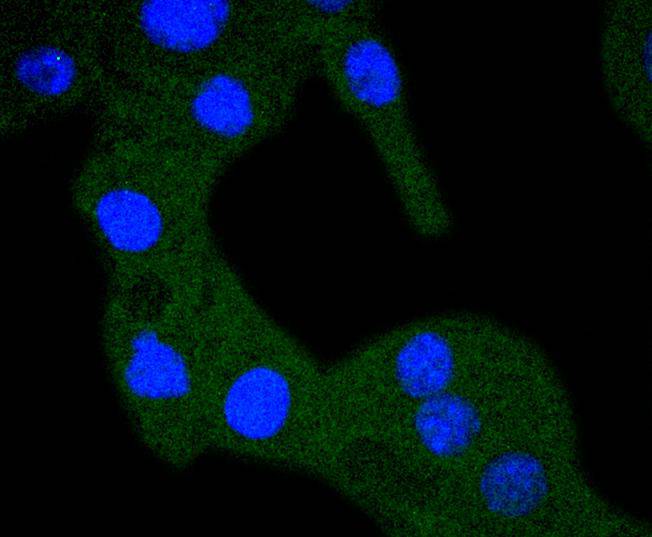 ICC staining of RPS20 in B16F1 cells (green). Formalin fixed cells were permeabilized with 0.1% Triton X-100 in TBS for 10 minutes at room temperature and blocked with 1% Blocker BSA for 15 minutes at room temperature. Cells were probed with the primary antibody (ET1610-83, 1/50) for 1 hour at room temperature, washed with PBS. Alexa Fluor®488 Goat anti-Rabbit IgG was used as the secondary antibody at 1/1,000 dilution. The nuclear counter stain is DAPI (blue).