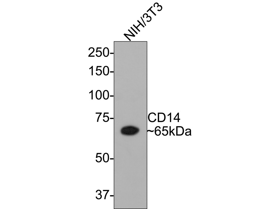 ICC staining of CD14 in A549 cells (green). Formalin fixed cells were permeabilized with 0.1% Triton X-100 in TBS for 10 minutes at room temperature and blocked with 10% negative goat serum for 15 minutes at room temperature. Cells were probed with the primary antibody (ET1610-85, 1/50) for 1 hour at room temperature, washed with PBS. Alexa Fluor®488 conjugate-Goat anti-Rabbit IgG was used as the secondary antibody at 1/1,000 dilution. The nuclear counter stain is DAPI (blue).