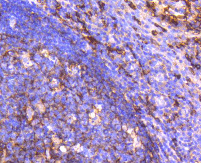 Immunohistochemical analysis of paraffin-embedded human spleen tissue with Rabbit anti-CD14 antibody (ET1610-85) at 1/200 dilution.<br />
<br />
The section was pre-treated using heat mediated antigen retrieval with Tris-EDTA buffer (pH 9.0) for 20 minutes. The tissues were blocked in 1% BSA for 20 minutes at room temperature, washed with ddH2O and PBS, and then probed with the primary antibody (ET1610-85) at 1/200 dilution for 1 hour at room temperature. The detection was performed using an HRP conjugated compact polymer system. DAB was used as the chromogen. Tissues were counterstained with hematoxylin and mounted with DPX.