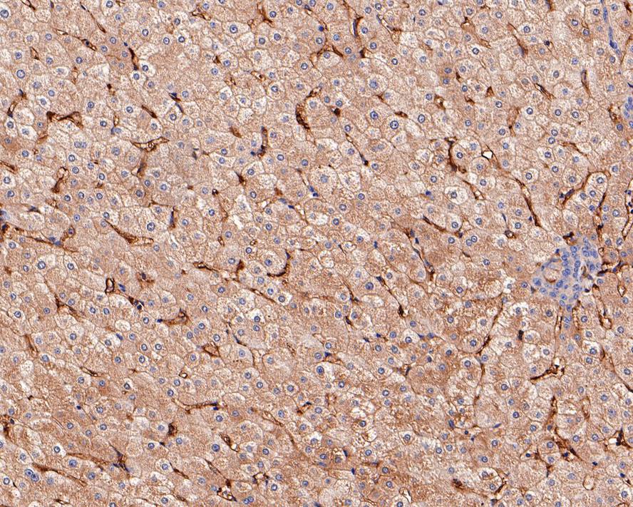 Immunohistochemical analysis of paraffin-embedded human uterus tissue using anti-CD14 antibody. The section was pre-treated using heat mediated antigen retrieval with Tris-EDTA buffer (pH 9.0) for 20 minutes.The tissues were blocked in 5% BSA for 30 minutes at room temperature, washed with ddH2O and PBS, and then probed with the primary antibody (ET1610-85, 1/50) for 30 minutes at room temperature. The detection was performed using an HRP conjugated compact polymer system. DAB was used as the chromogen. Tissues were counterstained with hematoxylin and mounted with DPX.