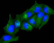 ICC staining of Adiponectin receptor protein 1 in Hela cells (green). Formalin fixed cells were permeabilized with 0.1% Triton X-100 in TBS for 10 minutes at room temperature and blocked with 1% Blocker BSA for 15 minutes at room temperature. Cells were probed with the primary antibody (ET1610-86, 1/50) for 1 hour at room temperature, washed with PBS. Alexa Fluor®488 Goat anti-Rabbit IgG was used as the secondary antibody at 1/1,000 dilution. The nuclear counter stain is DAPI (blue).