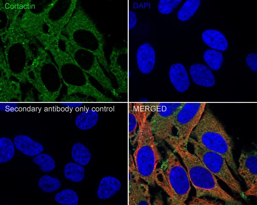 ICC staining of Cortactin in Hela cells (green). Formalin fixed cells were permeabilized with 0.1% Triton X-100 in TBS for 10 minutes at room temperature and blocked with 1% Blocker BSA for 15 minutes at room temperature. Cells were probed with the primary antibody (ET1610-87, 1/50) for 1 hour at room temperature, washed with PBS. Alexa Fluor®488 Goat anti-Rabbit IgG was used as the secondary antibody at 1/1,000 dilution. The nuclear counter stain is DAPI (blue).
