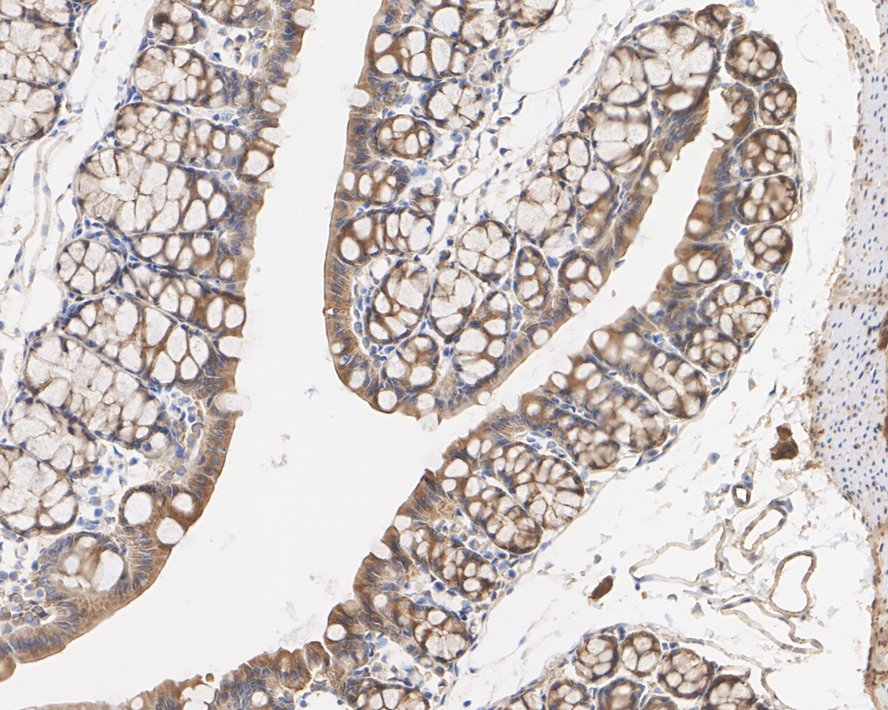 ICC staining of Cortactin in PC-3M cells (green). Formalin fixed cells were permeabilized with 0.1% Triton X-100 in TBS for 10 minutes at room temperature and blocked with 1% Blocker BSA for 15 minutes at room temperature. Cells were probed with the primary antibody (ET1610-87, 1/50) for 1 hour at room temperature, washed with PBS. Alexa Fluor®488 Goat anti-Rabbit IgG was used as the secondary antibody at 1/1,000 dilution. The nuclear counter stain is DAPI (blue).
