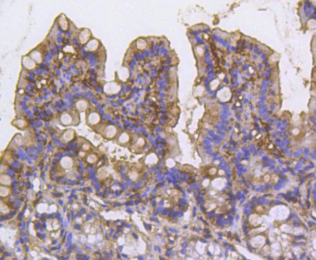 Immunohistochemical analysis of paraffin-embedded mouse colon tissue using anti-Cortactin antibody. The section was pre-treated using heat mediated antigen retrieval with Tris-EDTA buffer (pH 8.0-8.4) for 20 minutes.The tissues were blocked in 5% BSA for 30 minutes at room temperature, washed with ddH2O and PBS, and then probed with the primary antibody (ET1610-87, 1/50) for 30 minutes at room temperature. The detection was performed using an HRP conjugated compact polymer system. DAB was used as the chromogen. Tissues were counterstained with hematoxylin and mounted with DPX.