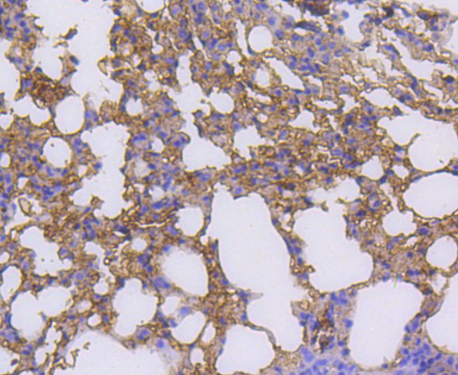 Immunohistochemical analysis of paraffin-embedded mouse lung tissue using anti-RALBP1 antibody. The section was pre-treated using heat mediated antigen retrieval with Tris-EDTA buffer (pH 8.0-8.4) for 20 minutes.The tissues were blocked in 5% BSA for 30 minutes at room temperature, washed with ddH2O and PBS, and then probed with the primary antibody (ET1610-88, 1/50) for 30 minutes at room temperature. The detection was performed using an HRP conjugated compact polymer system. DAB was used as the chromogen. Tissues were counterstained with hematoxylin and mounted with DPX.
