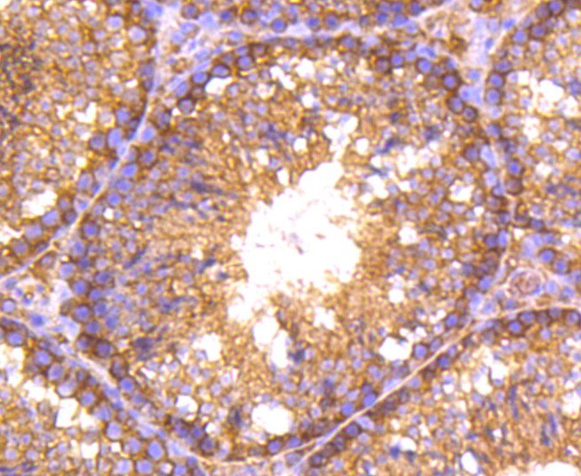 Immunohistochemical analysis of paraffin-embedded mouse testis tissue using anti-RALBP1 antibody. The section was pre-treated using heat mediated antigen retrieval with Tris-EDTA buffer (pH 8.0-8.4) for 20 minutes.The tissues were blocked in 5% BSA for 30 minutes at room temperature, washed with ddH2O and PBS, and then probed with the primary antibody (ET1610-88, 1/50) for 30 minutes at room temperature. The detection was performed using an HRP conjugated compact polymer system. DAB was used as the chromogen. Tissues were counterstained with hematoxylin and mounted with DPX.