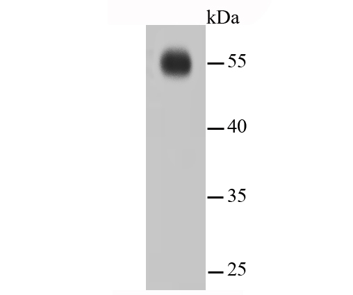 Western blot analysis of IRF7 on hybrid fish (crucian-carp) brain tissue lysates. Proteins were transferred to a PVDF membrane and blocked with 5% BSA in PBS for 1 hour at room temperature. The primary antibody (ET1610-89, 1/500) was used in 5% BSA at room temperature for 2 hours. Goat Anti-Rabbit IgG - HRP Secondary Antibody (HA1001) at 1:5,000 dilution was used for 1 hour at room temperature.