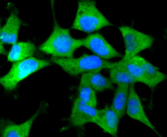 ICC staining of IRF7 in 293 cells (green). Formalin fixed cells were permeabilized with 0.1% Triton X-100 in TBS for 10 minutes at room temperature and blocked with 1% Blocker BSA for 15 minutes at room temperature. Cells were probed with the primary antibody (ET1610-89, 1/50) for 1 hour at room temperature, washed with PBS. Alexa Fluor®488 Goat anti-Rabbit IgG was used as the secondary antibody at 1/1,000 dilution. The nuclear counter stain is DAPI (blue).