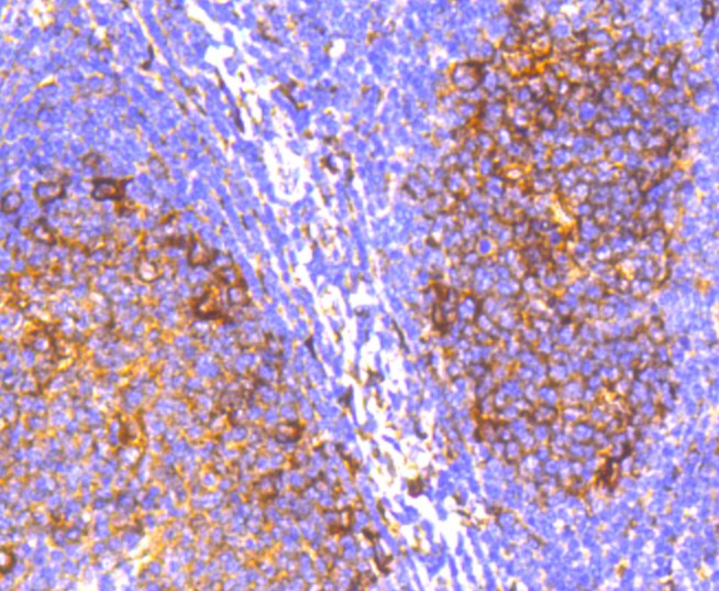 Immunohistochemical analysis of paraffin-embedded human tonsil tissue using anti-IRF7 antibody. The section was pre-treated using heat mediated antigen retrieval with Tris-EDTA buffer (pH 8.0-8.4) for 20 minutes.The tissues were blocked in 5% BSA for 30 minutes at room temperature, washed with ddH2O and PBS, and then probed with the primary antibody (ET1610-89, 1/50) for 30 minutes at room temperature. The detection was performed using an HRP conjugated compact polymer system. DAB was used as the chromogen. Tissues were counterstained with hematoxylin and mounted with DPX.