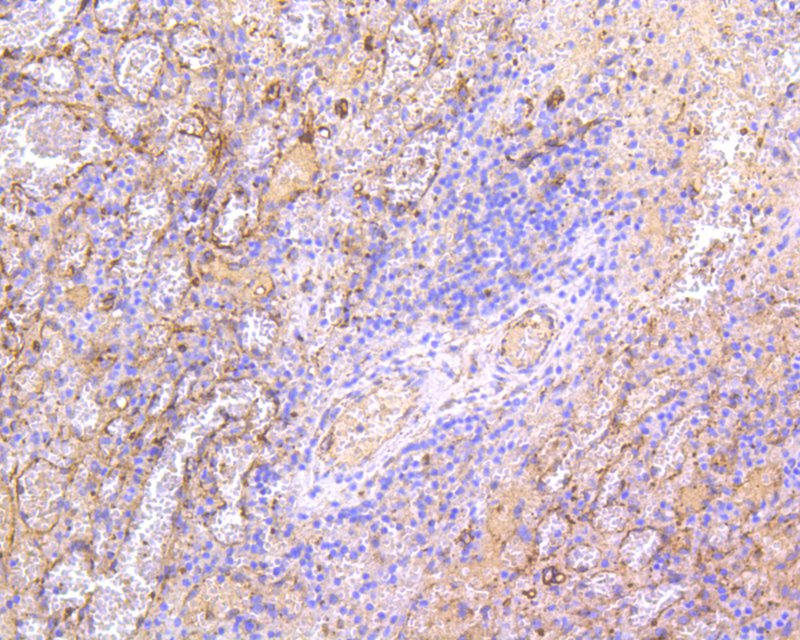 Immunohistochemical analysis of paraffin-embedded human spleen tissue using anti-IRF7 antibody. The section was pre-treated using heat mediated antigen retrieval with Tris-EDTA buffer (pH 8.0-8.4) for 20 minutes.The tissues were blocked in 5% BSA for 30 minutes at room temperature, washed with ddH2O and PBS, and then probed with the primary antibody (ET1610-89, 1/50) for 30 minutes at room temperature. The detection was performed using an HRP conjugated compact polymer system. DAB was used as the chromogen. Tissues were counterstained with hematoxylin and mounted with DPX.