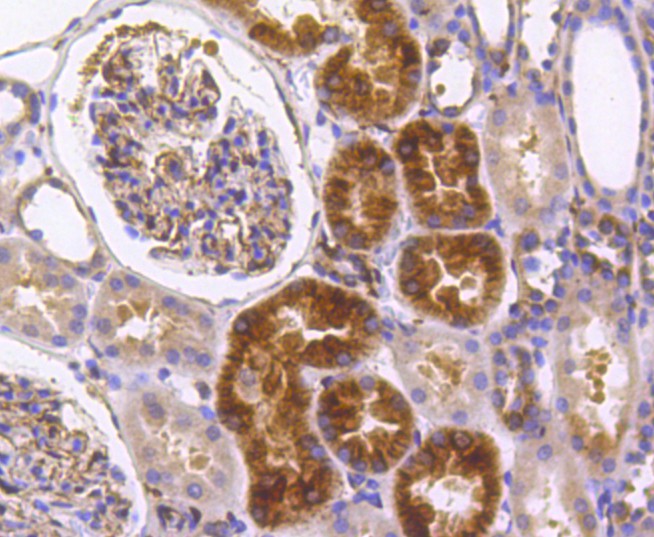 Immunohistochemical analysis of paraffin-embedded human kidney tissue using anti-IRF7 antibody. The section was pre-treated using heat mediated antigen retrieval with Tris-EDTA buffer (pH 8.0-8.4) for 20 minutes.The tissues were blocked in 5% BSA for 30 minutes at room temperature, washed with ddH2O and PBS, and then probed with the primary antibody (ET1610-89, 1/50) for 30 minutes at room temperature. The detection was performed using an HRP conjugated compact polymer system. DAB was used as the chromogen. Tissues were counterstained with hematoxylin and mounted with DPX.