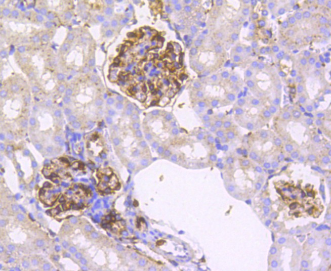 Immunohistochemical analysis of paraffin-embedded mouse kidney tissue using anti-IRF7 antibody. The section was pre-treated using heat mediated antigen retrieval with Tris-EDTA buffer (pH 8.0-8.4) for 20 minutes.The tissues were blocked in 5% BSA for 30 minutes at room temperature, washed with ddH2O and PBS, and then probed with the primary antibody (ET1610-89, 1/50) for 30 minutes at room temperature. The detection was performed using an HRP conjugated compact polymer system. DAB was used as the chromogen. Tissues were counterstained with hematoxylin and mounted with DPX.