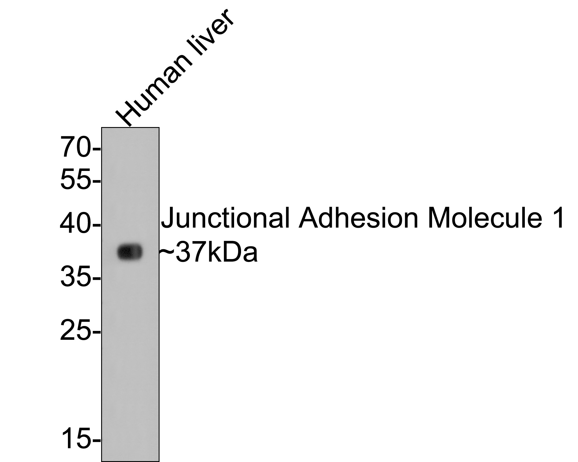 Western blot analysis of Junctional Adhesion Molecule 1 on human liver tissue lysates with Rabbit anti-Junctional Adhesion Molecule 1 antibody (ET1610-90) at 1/500 dilution.<br />
<br />
Lysates/proteins at 20 µg/Lane.<br />
<br />
Predicted band size: 33 kDa<br />
Observed band size: 37 kDa<br />
<br />
Exposure time: 30 seconds;<br />
<br />
12% SDS-PAGE gel.<br />
<br />
Proteins were transferred to a PVDF membrane and blocked with 5% NFDM/TBST for 1 hour at room temperature. The primary antibody (ET1610-90) at 1/500 dilution was used in 5% NFDM/TBST at room temperature for 2 hours. Goat Anti-Rabbit IgG - HRP Secondary Antibody (HA1001) at 1:300,000 dilution was used for 1 hour at room temperature.