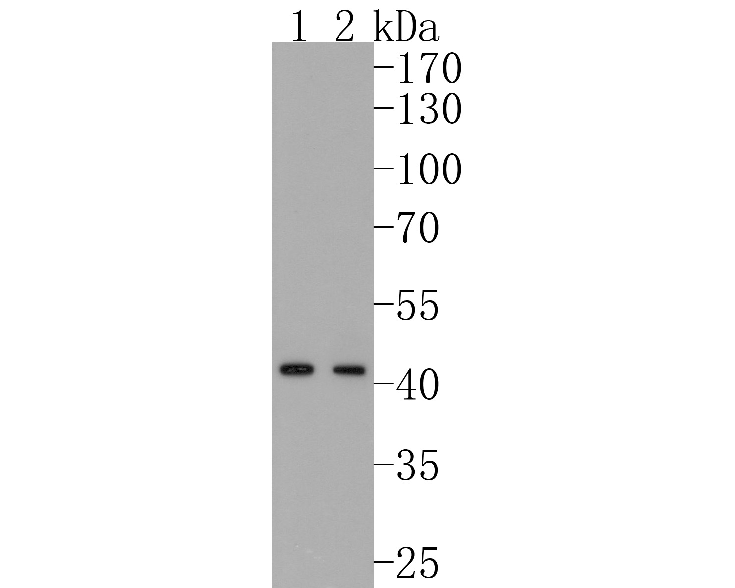 Western blot analysis of HMBS on different lysates. Proteins were transferred to a PVDF membrane and blocked with 5% BSA in PBS for 1 hour at room temperature. The primary antibody (ET1610-91, 1/500) was used in 5% BSA at room temperature for 2 hours. Goat Anti-Rabbit IgG - HRP Secondary Antibody (HA1001) at 1:200,000 dilution was used for 1 hour at room temperature.<br />
Positive control: <br />
Lane 1: Hela cell lysate<br />
Lane 2: 293T cell lysate