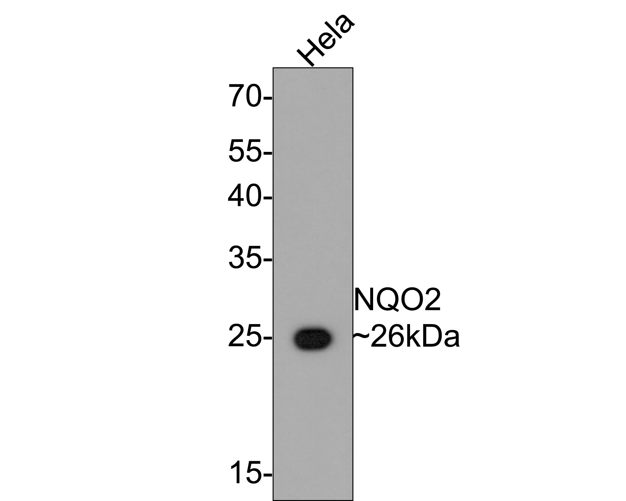 Western blot analysis of NQO2 on Hela cell lysates with Rabbit anti-NQO2 antibody (ET1610-92) at 1/500 dilution.<br />
<br />
Lysates/proteins at 10 µg/Lane.<br />
<br />
Predicted band size: 26 kDa<br />
Observed band size: 26 kDa<br />
<br />
Exposure time: 2 minutes;<br />
<br />
12% SDS-PAGE gel.<br />
<br />
Proteins were transferred to a PVDF membrane and blocked with 5% NFDM/TBST for 1 hour at room temperature. The primary antibody (ET1610-92) at 1/500 dilution was used in 5% NFDM/TBST at room temperature for 2 hours. Goat Anti-Rabbit IgG - HRP Secondary Antibody (HA1001) at 1:300,000 dilution was used for 1 hour at room temperature.