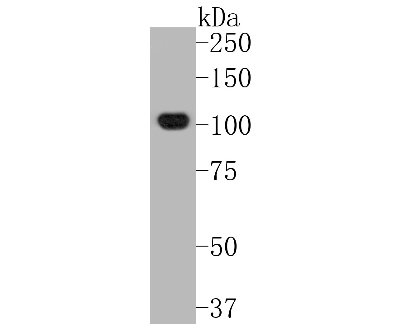 Western blot analysis of NLRP3 on human lung tissue lysates. Proteins were transferred to a PVDF membrane and blocked with 5% BSA in PBS for 1 hour at room temperature. The primary antibody (ET1610-93, 1/500) was used in 5% BSA at room temperature for 2 hours. Goat Anti-Rabbit IgG - HRP Secondary Antibody (HA1001) at 1:5,000 dilution was used for 1 hour at room temperature.