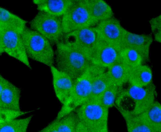 ICC staining of NLRP3 in PMVEC cells (green). Formalin fixed cells were permeabilized with 0.1% Triton X-100 in TBS for 10 minutes at room temperature and blocked with 1% Blocker BSA for 15 minutes at room temperature. Cells were probed with the primary antibody (ET1610-93, 1/50) for 1 hour at room temperature, washed with PBS. Alexa Fluor®488 Goat anti-Rabbit IgG was used as the secondary antibody at 1/1,000 dilution. The nuclear counter stain is DAPI (blue).