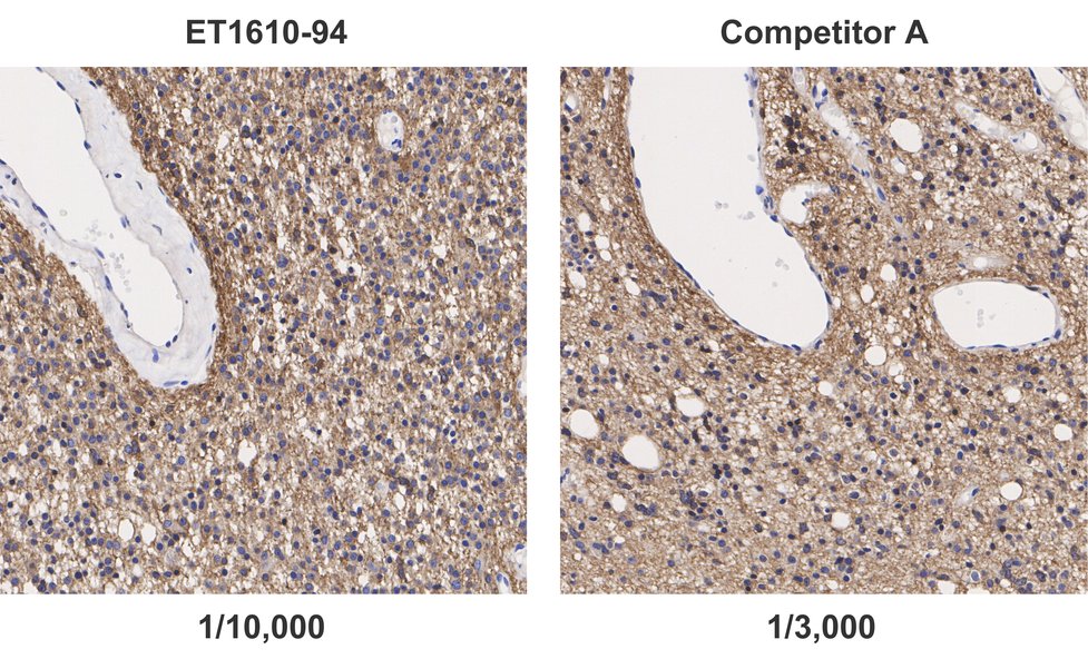 Immunohistochemical analysis of paraffin-embedded mouse brain tissue with Rabbit anti-GAP43 antibody (ET1610-94) at 1/15,000 dilution and competitor's antibody at 1/3,000 dilution.<br />
<br />
The section was pre-treated using heat mediated antigen retrieval with sodium citrate buffer (pH 6.0) for 2 minutes. The tissues were blocked in 1% BSA for 20 minutes at room temperature, washed with ddH2O and PBS, and then probed with the primary antibody (ET1610-94) at 1/15,000 dilution and competitor's antibody at 1/3,000 dilution for 1 hour at room temperature. The detection was performed using an HRP conjugated compact polymer system. DAB was used as the chromogen. Tissues were counterstained with hematoxylin and mounted with DPX.