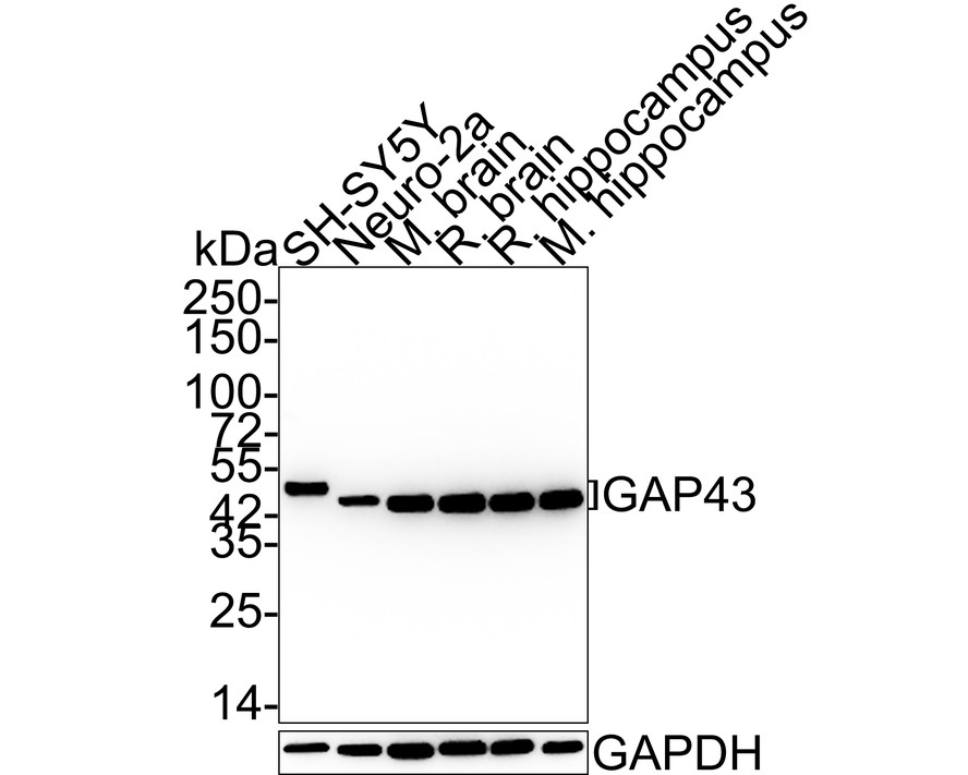Western blot analysis of GAP43 on different lysates with Rabbit anti-GAP43 antibody (ET1610-94) at 1/5,000 dilution.<br />
<br />
Lane 1: SH-SY5Y cell lysate<br />
Lane 2: Neuro-2a cell lysate<br />
Lane 3: Mouse brain tissue lysate<br />
Lane 4: Rat brain tissue lysate<br />
Lane 5: Rat hippocampus tissue lysate<br />
Lane 6: Mouse hippocampus tissue lysate<br />
<br />
Lysates/proteins at 20 µg/Lane.<br />
<br />
Predicted band size: 25 kDa<br />
Observed band size: 43/45 kDa<br />
<br />
Exposure time: 24 seconds;<br />
<br />
4-20% SDS-PAGE gel.<br />
<br />
Proteins were transferred to a PVDF membrane and blocked with 5% NFDM/TBST for 1 hour at room temperature. The primary antibody (ET1610-94) at 1/5,000 dilution was used in 5% NFDM/TBST at 4℃ overnight. Goat Anti-Rabbit IgG - HRP Secondary Antibody (HA1001) at 1:50,000 dilution was used for 1 hour at room temperature.