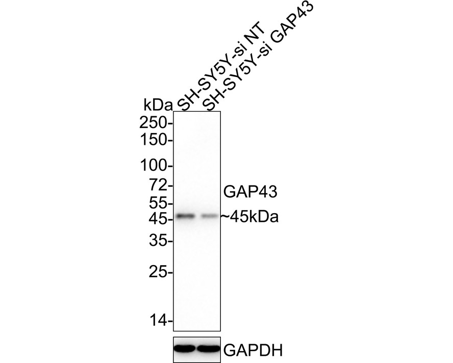Western blot analysis of GAP43 on different lysates with Rabbit anti-GAP43 antibody (ET1610-94) at 1/20,000 dilution.<br />
<br />
Lane 1: SH-SY5Y-si NT cell lysate<br />
Lane 2: SH-SY5Y-si GAP43 cell lysate<br />
<br />
Lysates/proteins at 10 µg/Lane.<br />
<br />
Predicted band size: 25 kDa<br />
Observed band size: 45 kDa<br />
<br />
Exposure time: 30 seconds;<br />
<br />
4-20% SDS-PAGE gel.<br />
<br />
Proteins were transferred to a PVDF membrane and blocked with 5% NFDM/TBST for 1 hour at room temperature. The primary antibody (ET1610-94) at 1/20,000 dilution was used in 5% NFDM/TBST at 4℃ overnight. Goat Anti-Rabbit IgG - HRP Secondary Antibody (HA1001) at 1/50,000 dilution was used for 1 hour at room temperature.