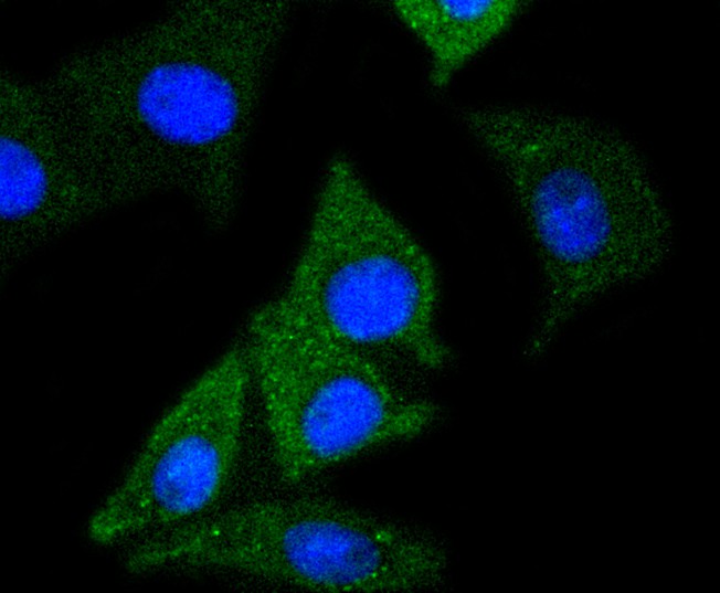ICC staining of NSE in SH-SY5Y cells (green). Formalin fixed cells were permeabilized with 0.1% Triton X-100 in TBS for 10 minutes at room temperature and blocked with 1% Blocker BSA for 15 minutes at room temperature. Cells were probed with the primary antibody (ET1610-96, 1/50) for 1 hour at room temperature, washed with PBS. Alexa Fluor®488 Goat anti-Rabbit IgG was used as the secondary antibody at 1/1,000 dilution. The nuclear counter stain is DAPI (blue).