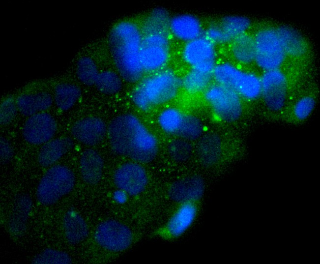 ICC staining of NSE in 293 cells (green). Formalin fixed cells were permeabilized with 0.1% Triton X-100 in TBS for 10 minutes at room temperature and blocked with 1% Blocker BSA for 15 minutes at room temperature. Cells were probed with the primary antibody (ET1610-96, 1/50) for 1 hour at room temperature, washed with PBS. Alexa Fluor®488 Goat anti-Rabbit IgG was used as the secondary antibody at 1/1,000 dilution. The nuclear counter stain is DAPI (blue).
