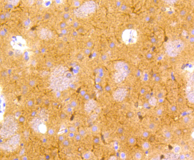 Immunohistochemical analysis of paraffin-embedded rat brain tissue using anti-NSE antibody. The section was pre-treated using heat mediated antigen retrieval with Tris-EDTA buffer (pH 8.0-8.4) for 20 minutes.The tissues were blocked in 5% BSA for 30 minutes at room temperature, washed with ddH2O and PBS, and then probed with the primary antibody (ET1610-96, 1/50) for 30 minutes at room temperature. The detection was performed using an HRP conjugated compact polymer system. DAB was used as the chromogen. Tissues were counterstained with hematoxylin and mounted with DPX.