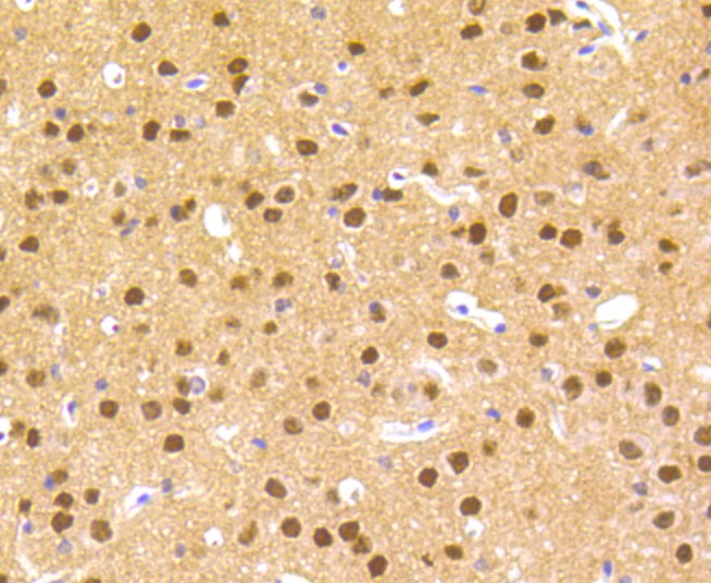 ICC staining of Hes1 in 293 cells (green). Formalin fixed cells were permeabilized with 0.1% Triton X-100 in TBS for 10 minutes at room temperature and blocked with 1% Blocker BSA for 15 minutes at room temperature. Cells were probed with the primary antibody (ET1610-97, 1/50) for 1 hour at room temperature, washed with PBS. Alexa Fluor®488 Goat anti-Rabbit IgG was used as the secondary antibody at 1/1,000 dilution. The nuclear counter stain is DAPI (blue).