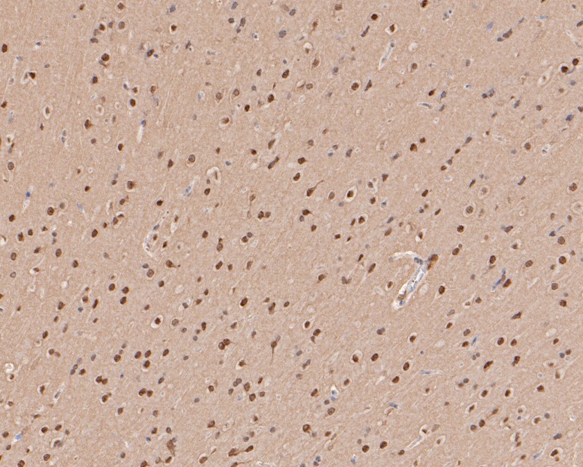 Immunohistochemical analysis of paraffin-embedded mouse brain tissue using anti-Hes1 antibody. The section was pre-treated using heat mediated antigen retrieval with sodium citrate buffer (pH 6.0) for 20 minutes. The tissues were blocked in 5% BSA for 30 minutes at room temperature, washed with ddH2O and PBS, and then probed with the primary antibody (ET1610-97, 1/200)  for 30 minutes at room temperature. The detection was performed using an HRP conjugated compact polymer system. DAB was used as the chromogen. Tissues were counterstained with hematoxylin and mounted with DPX.