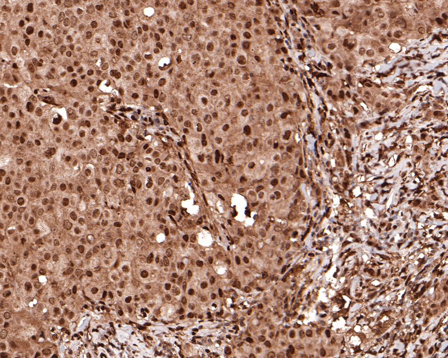 Immunohistochemical analysis of paraffin-embedded rat brain tissue using anti-Hes1 antibody. The section was pre-treated using heat mediated antigen retrieval with sodium citrate buffer (pH 6.0) for 20 minutes. The tissues were blocked in 5% BSA for 30 minutes at room temperature, washed with ddH2O and PBS, and then probed with the primary antibody (ET1610-97, 1/200)  for 30 minutes at room temperature. The detection was performed using an HRP conjugated compact polymer system. DAB was used as the chromogen. Tissues were counterstained with hematoxylin and mounted with DPX.